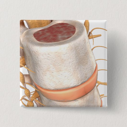 Sluit een ongewervelde schijf in de wervelkolom vierkante button 5,1 cm (Voorkant)