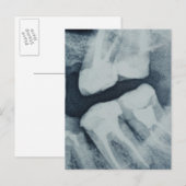 Sluiten van een tandheelkundige röntgenfoto briefkaart (Voorkant / Achterkant)