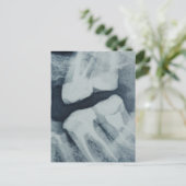 Sluiten van een tandheelkundige röntgenfoto briefkaart (Staand voorkant)