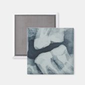 Sluiten van een tandheelkundige röntgenfoto magneet (Voorkant / Achterkant)