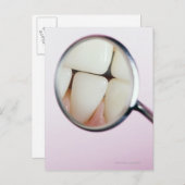 Sluiting van tanden in tandspiegel briefkaart (Voorkant / Achterkant)