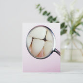 Sluiting van tanden in tandspiegel briefkaart (Staand voorkant)