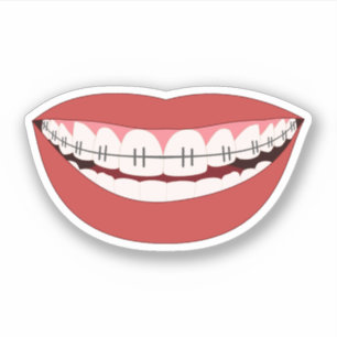 Smile Orthodontic Appliance Sticker