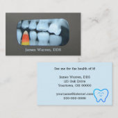 Snoep in tandenröntgenfoto visitekaartje (Voorkant / Achterkant)