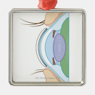 Soft Contact Lens Metalen Ornament