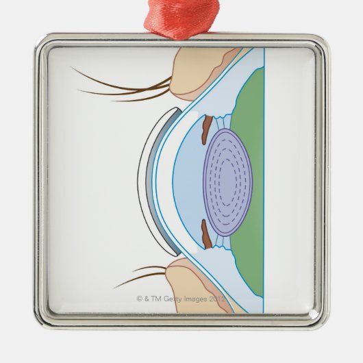 Soft Contact Lens Metalen Ornament (Voorkant)