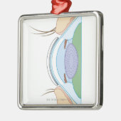 Soft Contact Lens Metalen Ornament (Links)