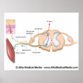 Somatische reflex, met opschrift schema. poster (Voorkant)