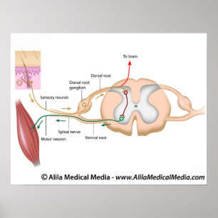 Somatische reflex, met opschrift schema. poster