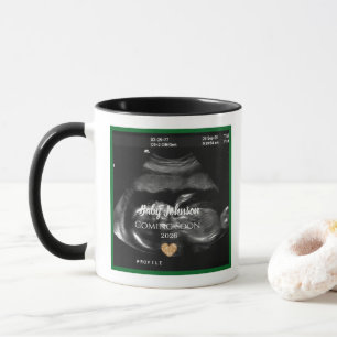 Sonogram Baby binnenkort aangekondigd voor opa Mok