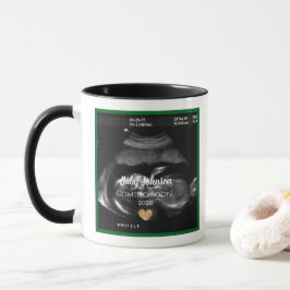 Sonogram Baby binnenkort aangekondigd voor Uncle Mok