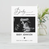 Sonogram Baby binnenkort zwangerschapsaankondiging Kaart (Staand voorkant)