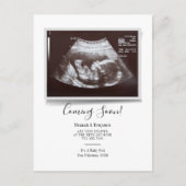 Sonogram Baby Scan Ultrasound Zwangerschap Aankondigingskaart (Voorkant)