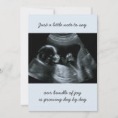 Sonogram Foto Bleek Blauwe Zwangerschap Aankondigi Aankondiging (Voorkant)