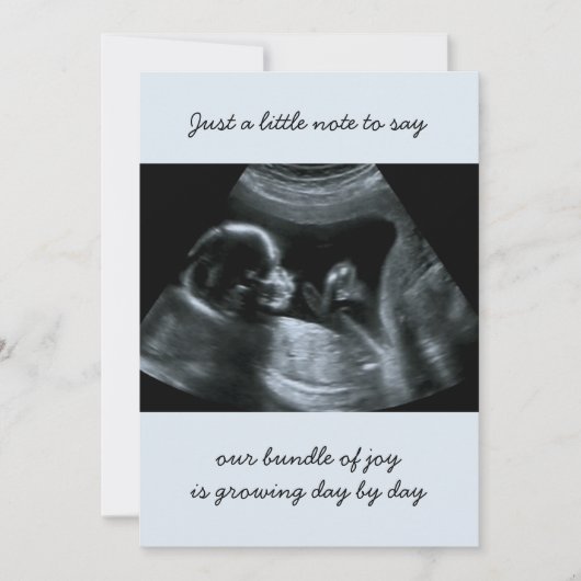 Sonogram Foto Bleek Blauwe Zwangerschap Aankondigi Aankondiging (Voorkant)