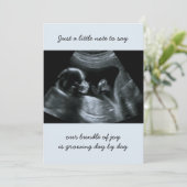 Sonogram Foto Bleek Blauwe Zwangerschap Aankondigi Aankondiging (Staand voorkant)