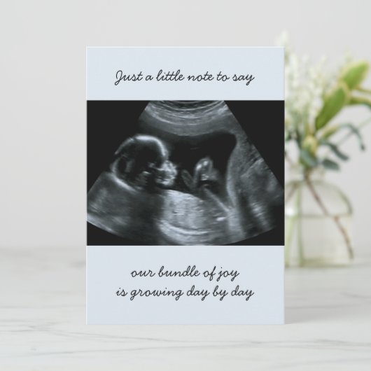 Sonogram Foto Bleek Blauwe Zwangerschap Aankondigi Aankondiging (Staand voorkant)