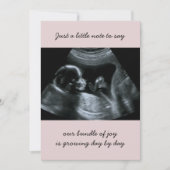 Sonogram Foto Bleek Roze Zwangerschap Aankondiging (Voorkant)
