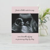 Sonogram Foto Bleek Roze Zwangerschap Aankondiging (Staand voorkant)