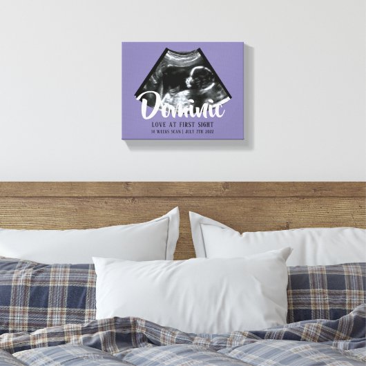 Sonogram Keepsake Baby Echografie Canvas Print (Insitu (Slaapkamer))