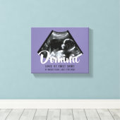 Sonogram Keepsake Baby Echografie Canvas Print (Insitu (Houten vloer))