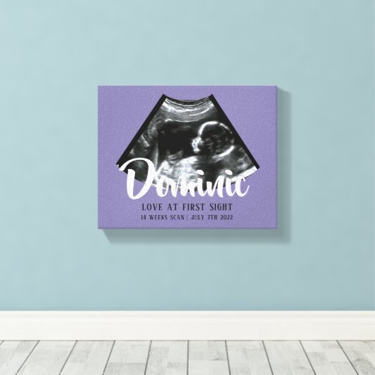 Sonogram Keepsake Baby Echografie Canvas Print (Insitu (Houten vloer))