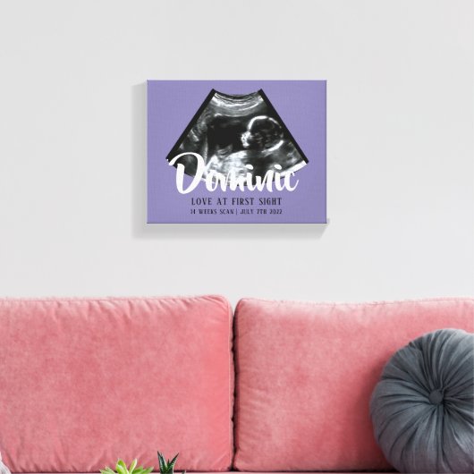 Sonogram Keepsake Baby Echografie Canvas Print (Insitu (Woonkamer))
