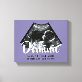 Sonogram Keepsake Baby Echografie Canvas Print