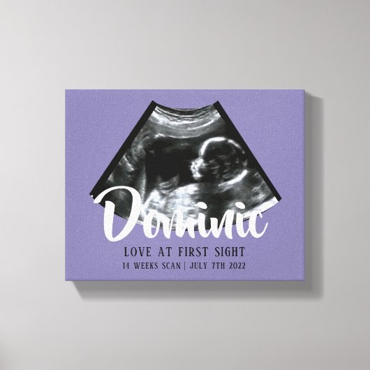 Sonogram Keepsake Baby Echografie Canvas Print (Voorkant)