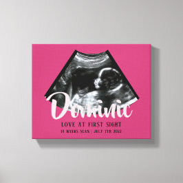 Sonogram Keepsake Baby Echografie Canvas Print