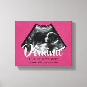 Sonogram Keepsake Baby Echografie Canvas Print