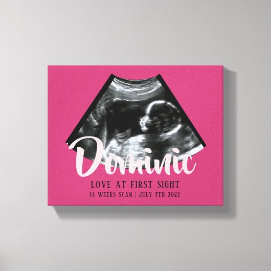 Sonogram Keepsake Baby Echografie Canvas Print (Voorkant)