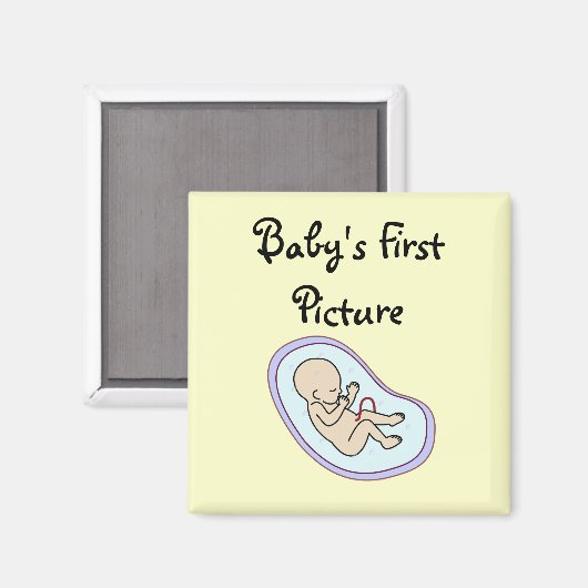 "Sonogram" magneet (Voorkant / Achterkant)