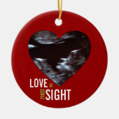 Sonogram Ornament - Liefde op eerste acht (Voorkant)