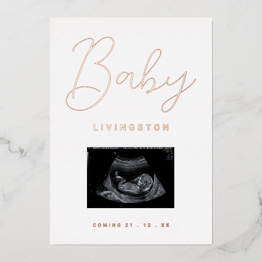 Sonogram Roos Gold Foil Zwangerschap Aankondiging (Voorkant)