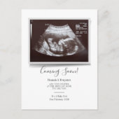 Sonogram Typografie Ultrageluid Foto Zwangerschap Aankondigingskaart (Voorkant)