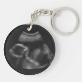 Sonogram van de baby van de multicolor op maat Ver Sleutelhanger (Achterkant)