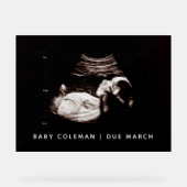 Sonogram van zwangerschapsaankondiging Baby shower Acryl Bord (Voorkant)