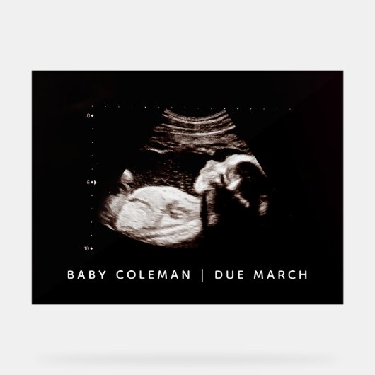 Sonogram van zwangerschapsaankondiging Baby shower Acryl Bord (Voorkant)