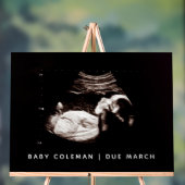 Sonogram van zwangerschapsaankondiging Baby shower Acryl Bord (Neutraal)