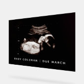 Sonogram van zwangerschapsaankondiging Baby shower Acryl Bord (Hoek)