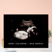 Sonogram van zwangerschapsaankondiging Baby shower Acryl Bord (Huwelijk)