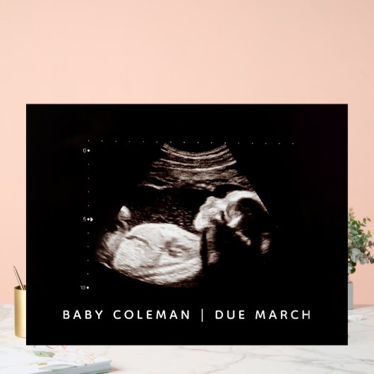 Sonogram van zwangerschapsaankondiging Baby shower Acryl Bord (Huwelijk)