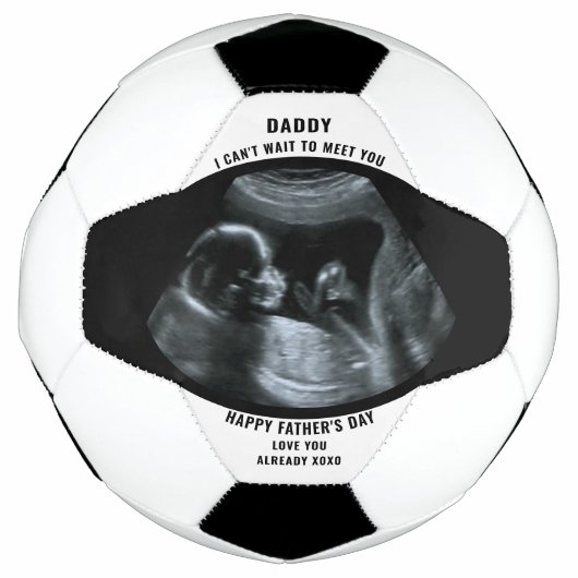 Sonogram Zwangerschap Foto Zwart Wit Gepersonalise Voetbal (Voorkant)