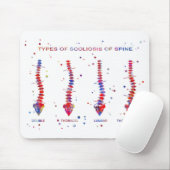 Soort scoliose van de wervelkolom muismat (Met muis)