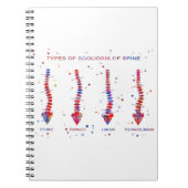 Soort scoliose van de wervelkolom notitieboek (Voorkant)