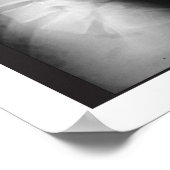 Spaandegeneratie Poster in Spaanstalige fase (Hoek)