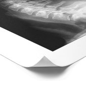 Spaanse subluxueuze cervicale degeneratie van de r poster (Hoek)