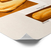 Spier Oppervlak Anatomie Poster Arm & Schouder (Hoek)