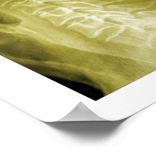 Spinal Degeneration Cervical Spine Chiropractic Poster (Hoek)